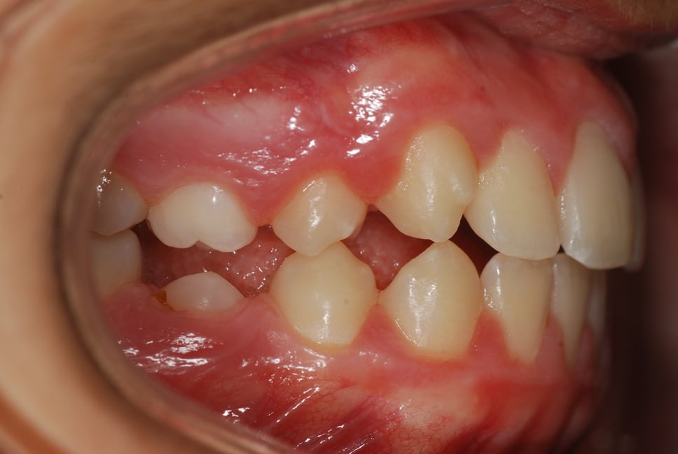 Traumatologia dentária